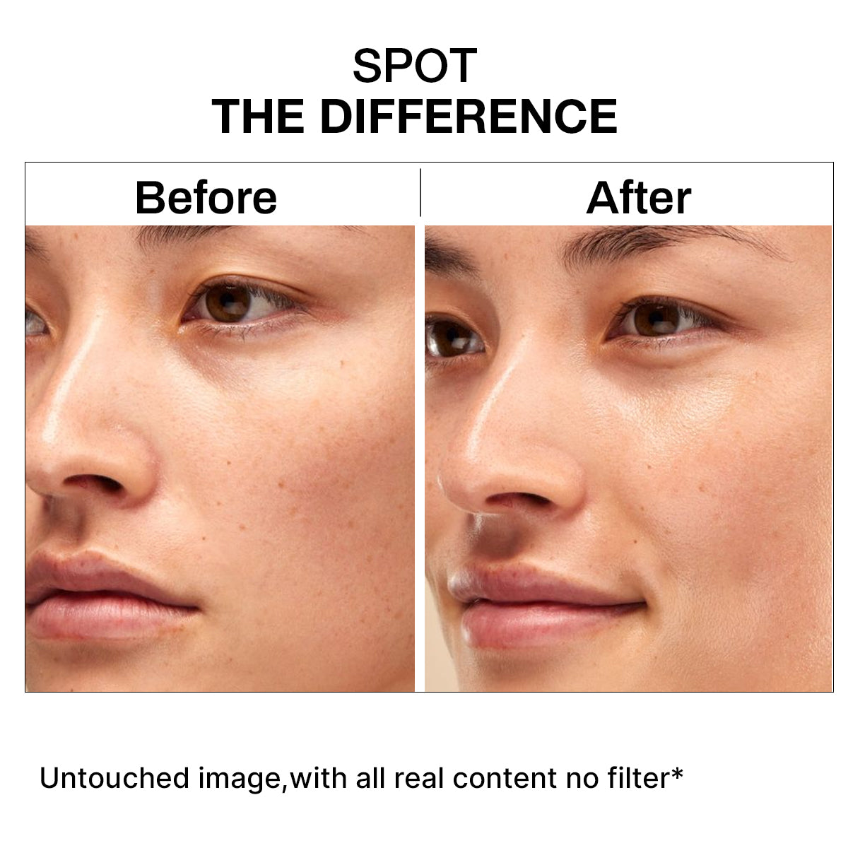 Niacinamide 10% Serum