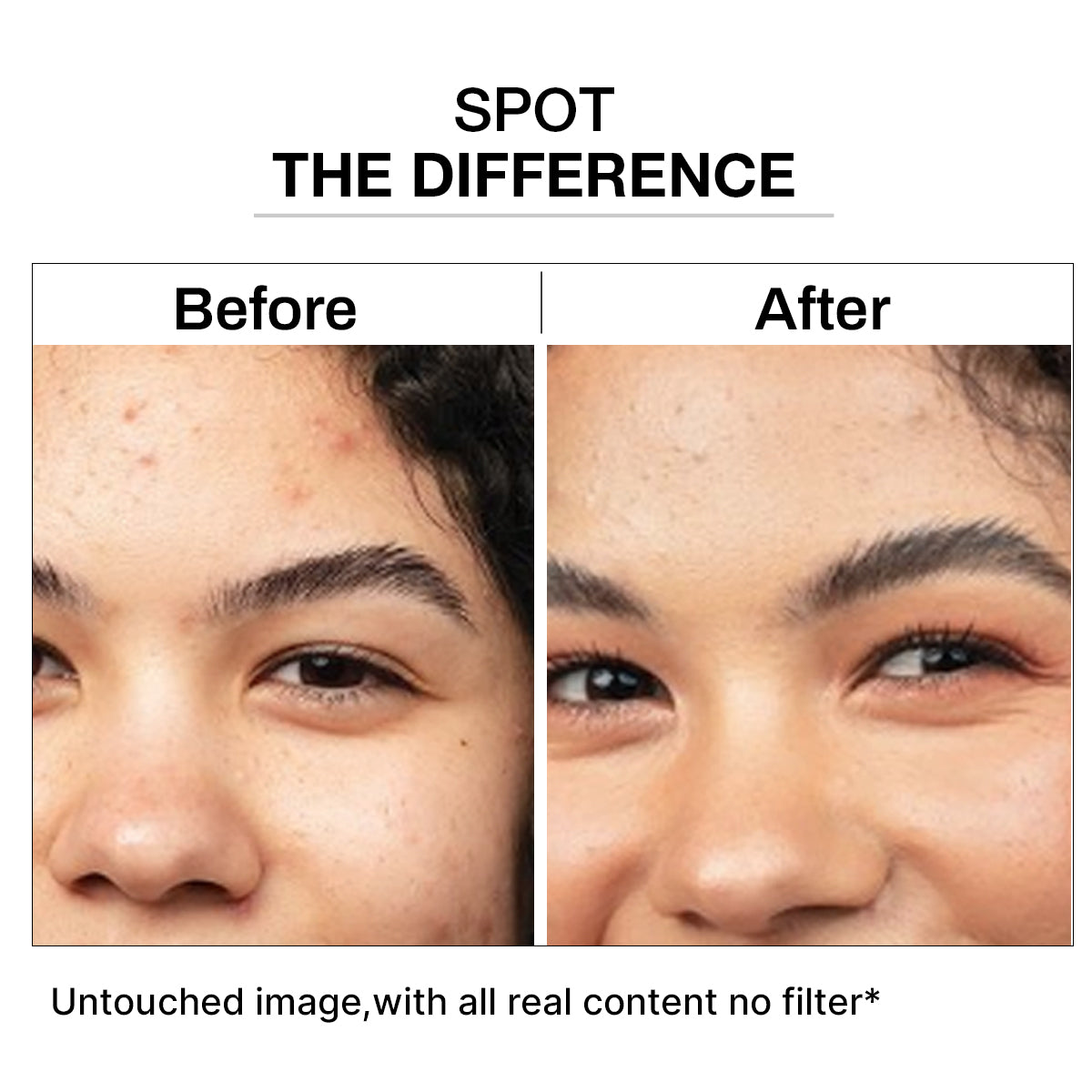kojic
