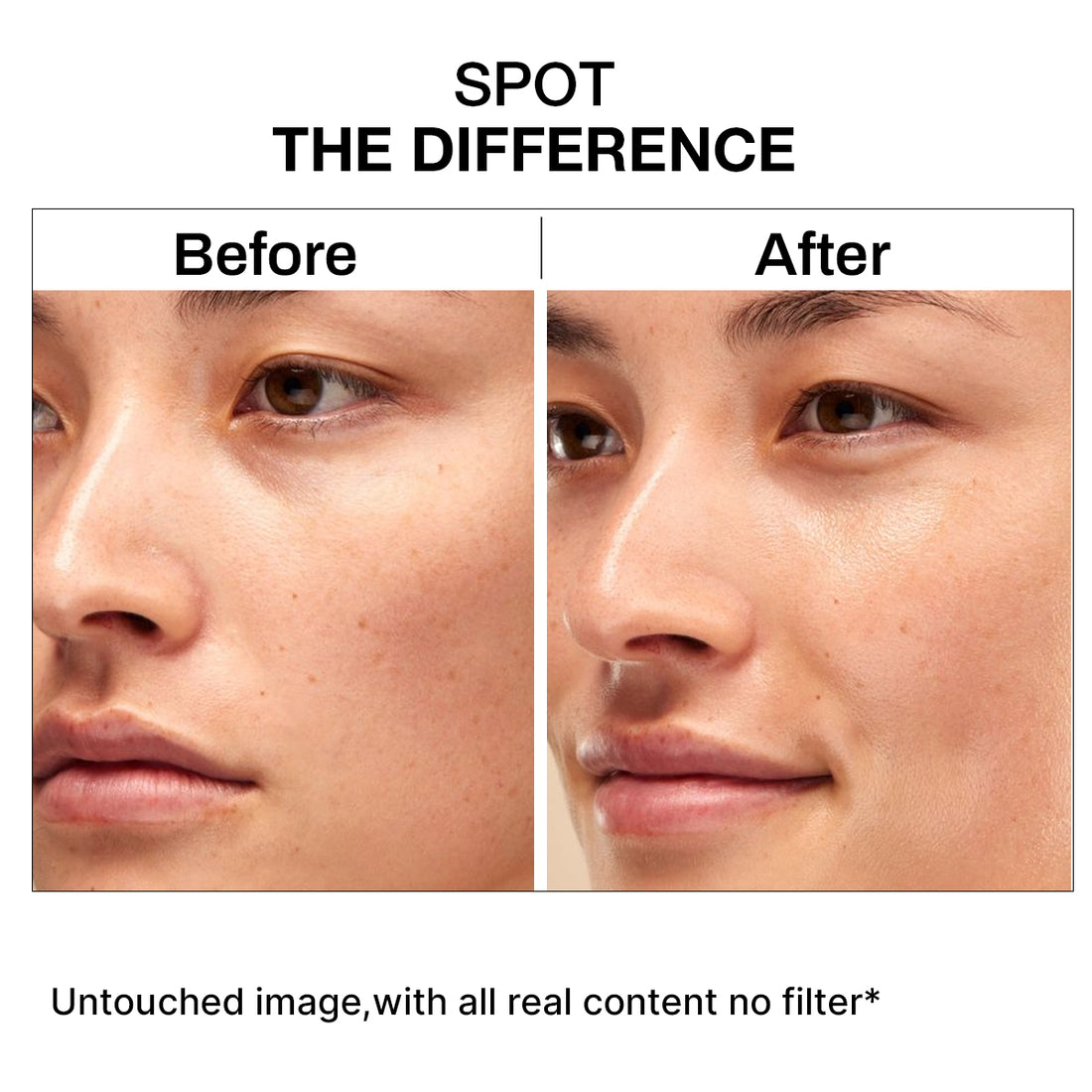 Niacinamide 10% Serum