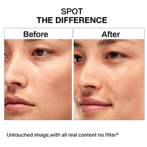 Niacinamide 10% Serum