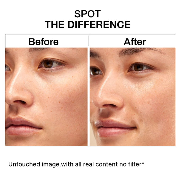 Niacinamide 10% Serum